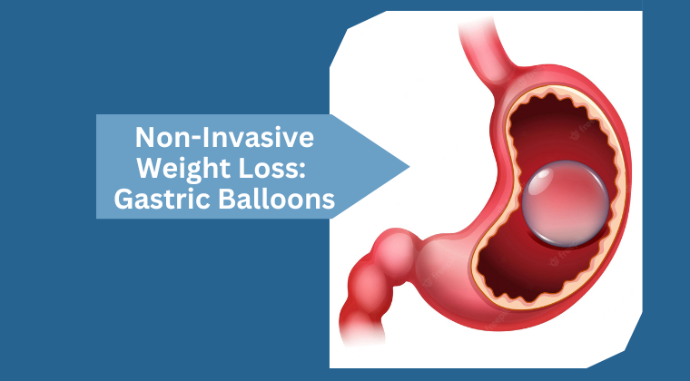 Non-Invasive Weight Loss Gastric Balloons