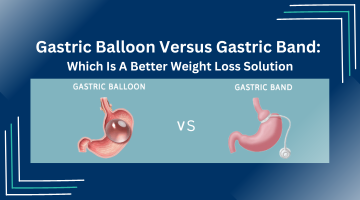 Gastric Balloon Versus Gastric Band