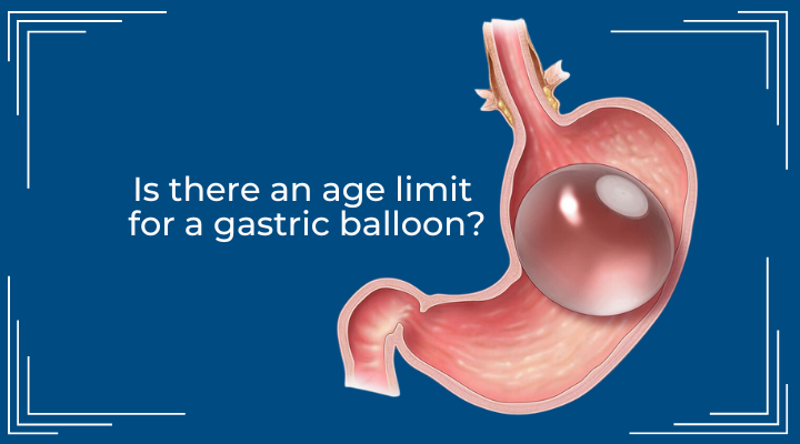 Is there an age limit for a gastric balloon